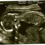 Baby 10005