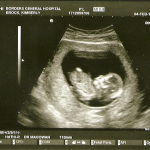 scan0002